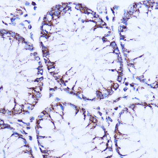 Anti-NDUFB9 Antibody (CAB17454)