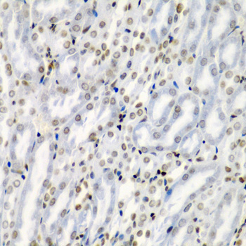 Anti-TNFSF10 Antibody (CAB2138)