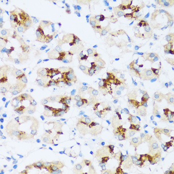 Anti-ARSB Antibody (CAB16765)