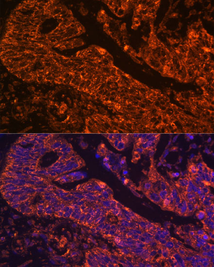 Anti-AXL Antibody (CAB17874)