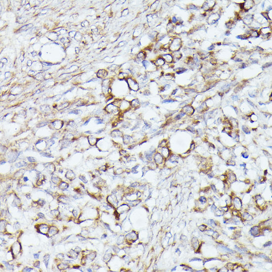 Anti-ACAT2 Antibody (CAB7866)