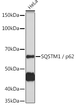 Anti-SQSTM1 / p62 Antibody (CAB11247)