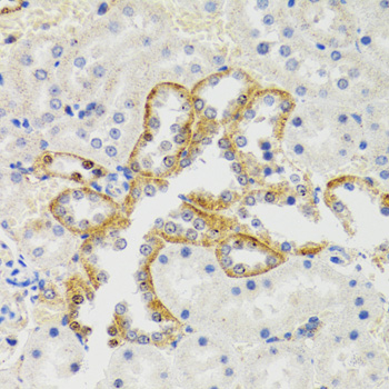 Anti-SH2B1 Antibody (CAB5564)