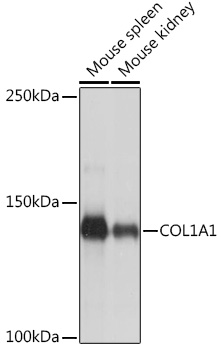 Anti-COL1A1 Antibody (CAB16891)