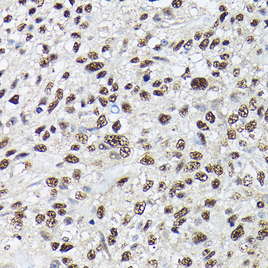 Anti-SRSF2 Antibody (CAB3635)