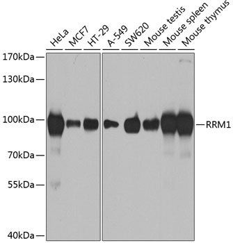 Anti-RRM1 Antibody (CAB1152)