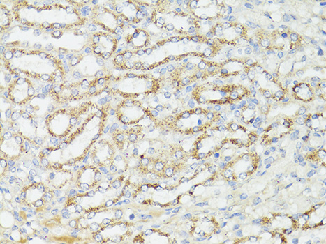 Anti-mTOR Antibody (CAB11354)