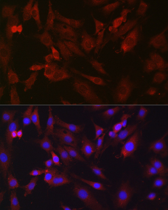 Anti-BDKRB1 Antibody (CAB1959)