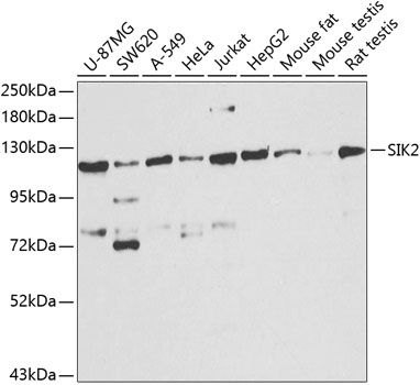 Anti-SIK2 Polyclonal Antibody (CAB8321)