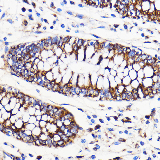 Anti-Mitofusin 2 Antibody (CAB12771)