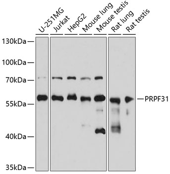Anti-PRPF31 Antibody (CAB5732)