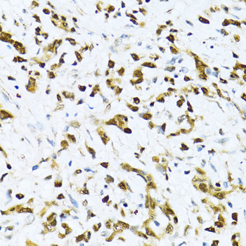 Anti-ITGB3BP Antibody (CAB14859)