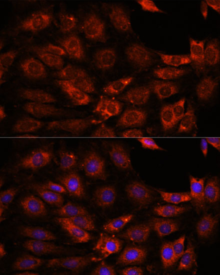 Anti-GIT1 Antibody [KO Validated] (CAB15437)