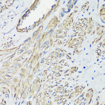 Anti-FLNA Antibody (CAB7896)