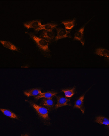 Anti-ADORA2A Antibody (CAB1587)