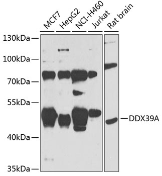 Anti-DDX39A Polyclonal Antibody (CAB7955)