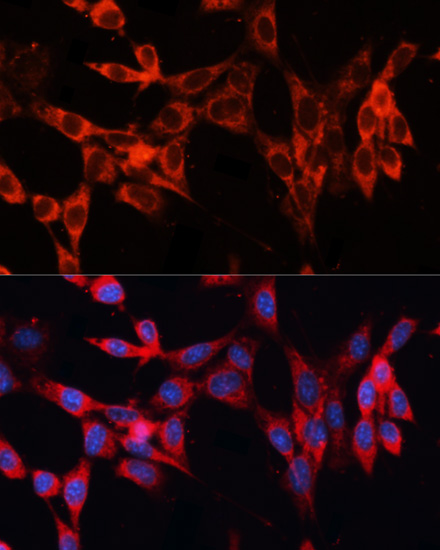 Anti-SLC29A1 Antibody (CAB13205)