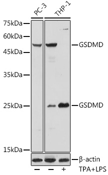 Anti-GSDMD Antibody (CAB18281)