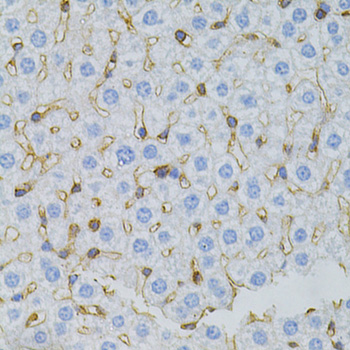 Anti-MSN Antibody (CAB12463)