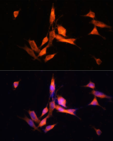 Anti-MMP10 Antibody (CAB3033)