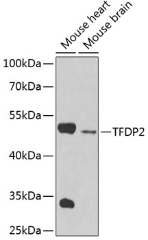 Anti-TFDP2 Antibody (CAB4152)