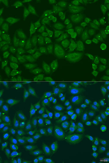 Anti-INPP5K Antibody (CAB7807)