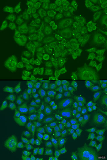 Anti-NDUFS7 Antibody (CAB7862)