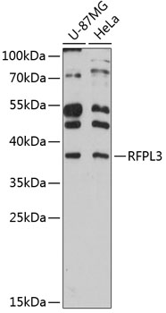 Anti-RFPL3 Antibody (CAB12361)