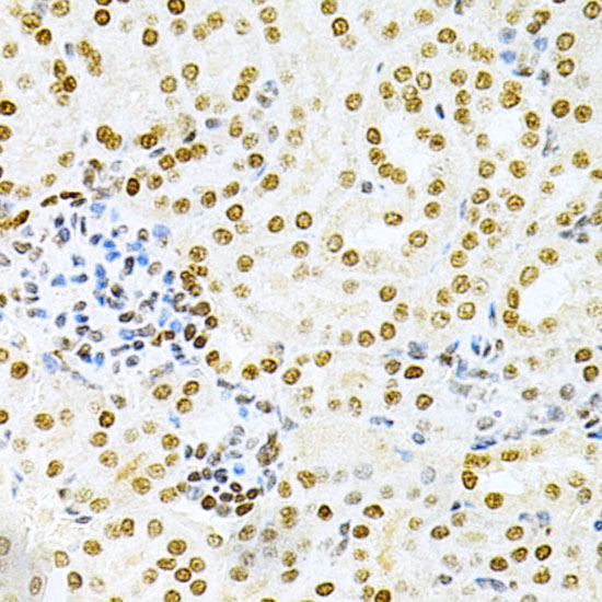 Anti-DKC1 Antibody (CAB1862)