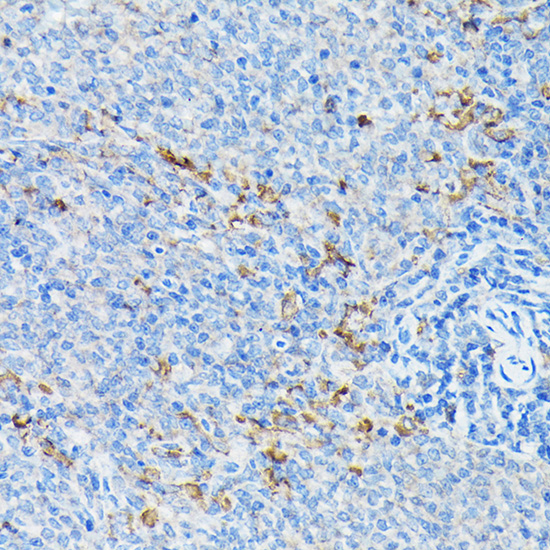 Anti-CYP1A1 Antibody (CAB2159)