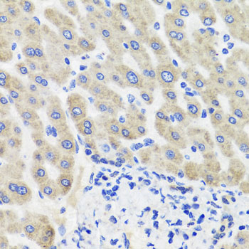 Anti-HSD11B2 Polyclonal Antibody (CAB8077)