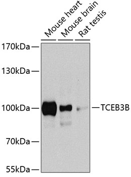 Anti-Elongin-A2 Polyclonal Antibody (CAB8492)