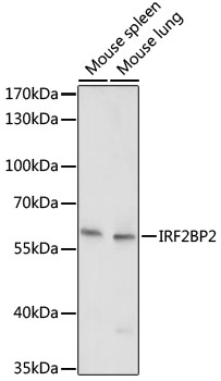 Anti-IRF2BP2 Antibody (CAB17985)