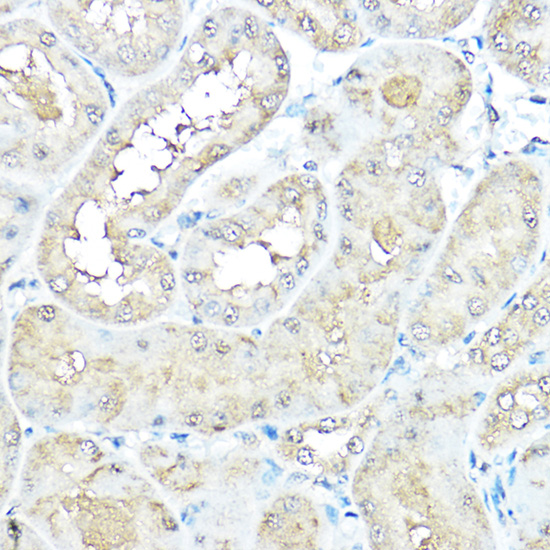 Anti-VCP Antibody (CAB2795)