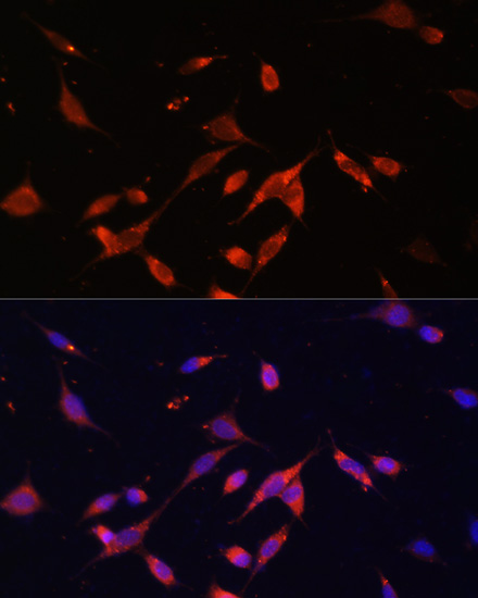 Anti-PIK3R2 Antibody (CAB17433)