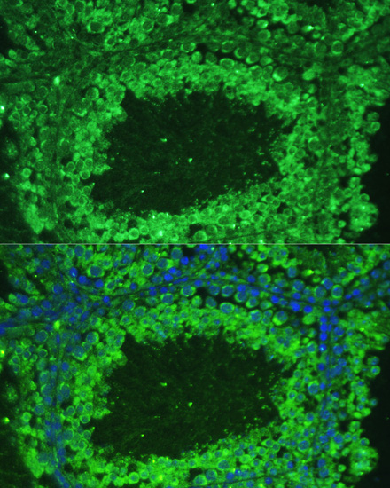 Anti-ASZ1 Antibody (CAB14447)