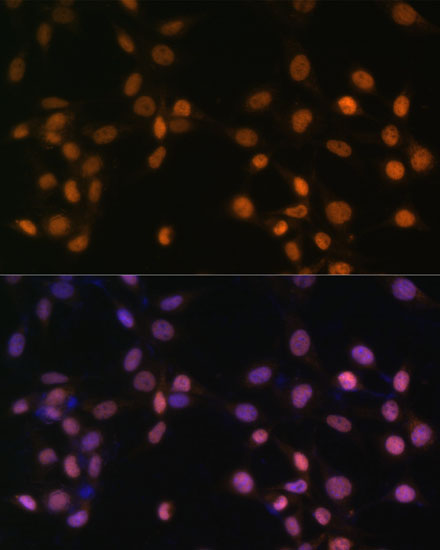 Anti-c-Jun Antibody (CAB0246)