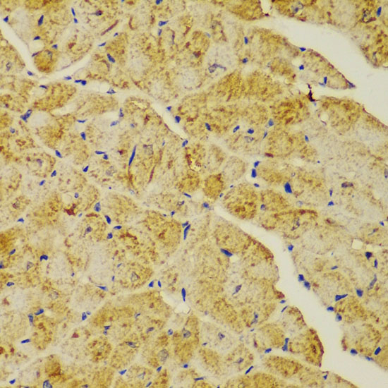 Anti-ACTN1 Antibody (CAB1160)