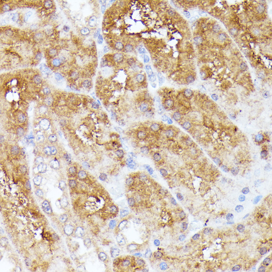 Anti-CLNS1A Antibody (CAB16040)