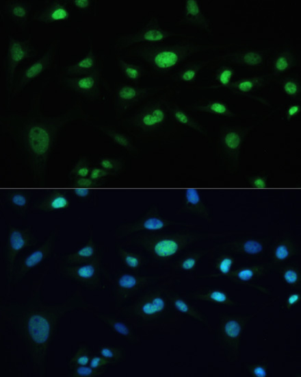 Anti-MDC1 Polyclonal Antibody (CAB8358)