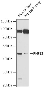 Anti-RNF13 Polyclonal Antibody (CAB8363)