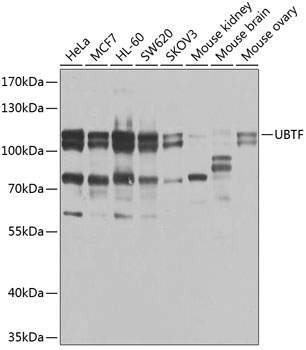 Anti-UBTF Polyclonal Antibody (CAB9847)