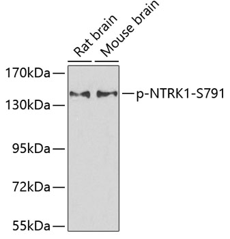 Anti-Phospho-NTRK1-S791 Antibody (CABP0272)