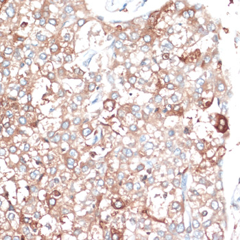 Anti-SLAMF7 Antibody (CAB16565)