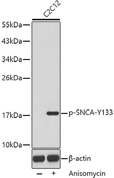 Anti-Phospho-Alpha-synuclein-Y133 Antibody (CABP0451)