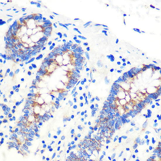 Anti-SCO2 Antibody (CAB7051)