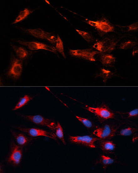 Anti-MAP1B Antibody (CAB3305)