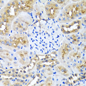 Anti-Ninein Polyclonal Antibody (CAB8215)