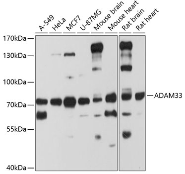 Anti-ADAM33 Polyclonal Antibody (CAB8265)