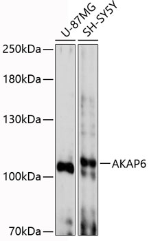 Anti-AKAP6 Antibody (CAB12798)